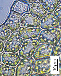 オンタケクサリゴケの葉身細胞