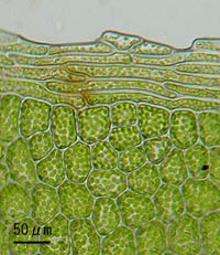 オオバチョウチンゴケの葉身細胞