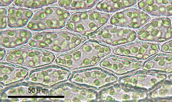 オオハリガネゴケの葉身細胞