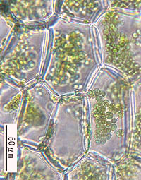 オタルヤバネゴケの細胞