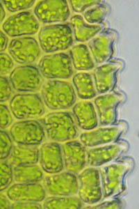 サクラジマホウオウゴケの細胞のパピラ