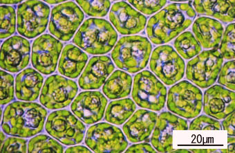 シゲリゴケの葉身細胞