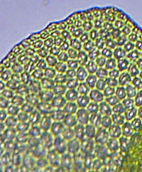 シゲリゴケの細胞2