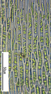 タニゴケの葉身細胞