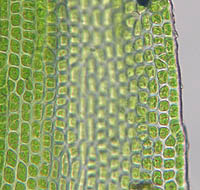 チヂミバコブゴケの葉身細胞