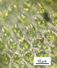 トヤマシノブゴケの葉身細胞パピラ