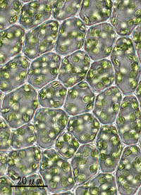 ツボゴケの葉身細胞