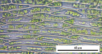 ツクシナギゴケ葉身細胞
