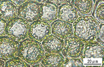 ツクシウロコゴケ葉身細胞