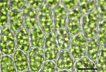 ツルチョウチンゴケ葉身細胞
