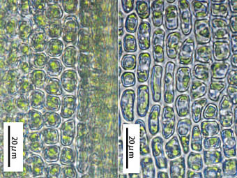 ツチノウエノタマゴケ葉身細胞
