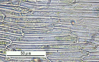 ウマスギゴケ葉鞘の透明細胞