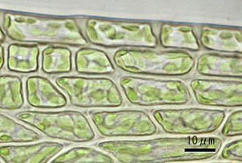 ヤマトフデゴケ葉縁の細胞