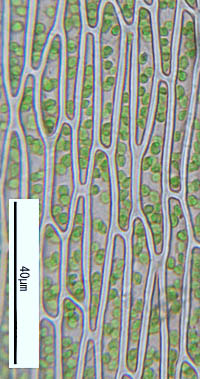 ヤノネゴケの葉身細胞
