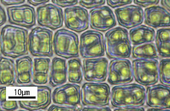 ヤノウエノアカゴケの葉身細胞