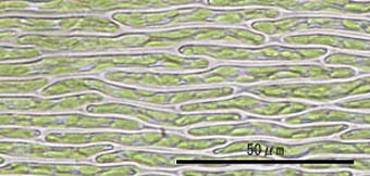 ヤリノホゴケ葉身細胞