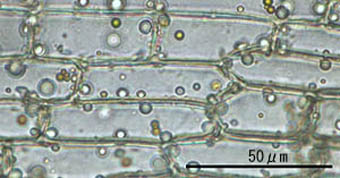 ユミダイゴケ葉基部の葉身細胞