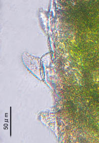 アイオオアカウキクサ葉表面の突起