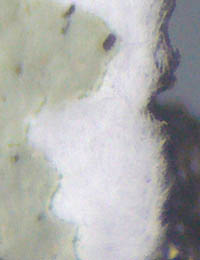 キウメノキゴケ髄層