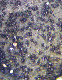 トゲカワホリゴケの粒状の裂芽